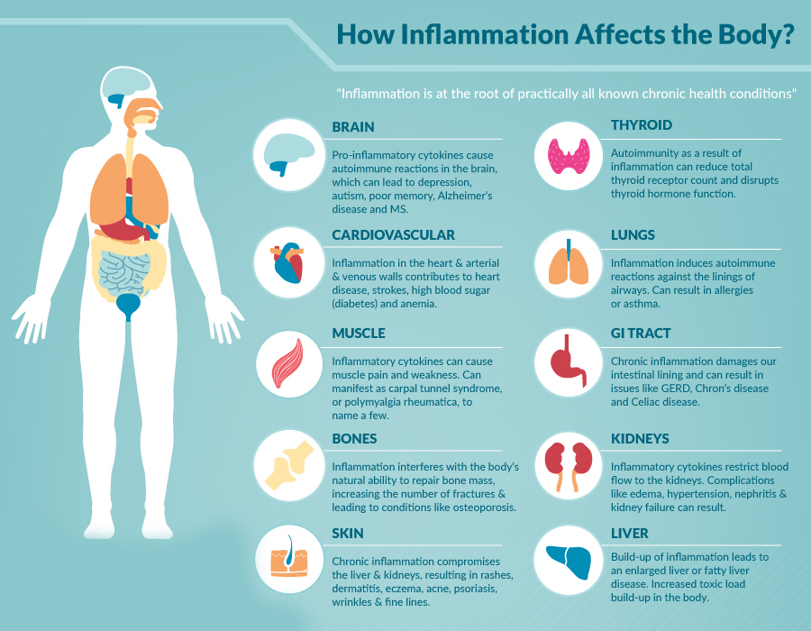 INFLAMMATION Understanding How It Can Affect Your Long term Health INFLAMMATION Understanding How It Can Affect Your Long term Health